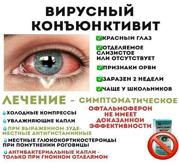 Как быстро лечить конъюнктивит. Схема лечения бактериального конъюнктивита. бактериальный 1 конъюнктивит у детей. глазная болезнь конъюнктивит. конъюнктивит основные клинические проявления и симптомы.
