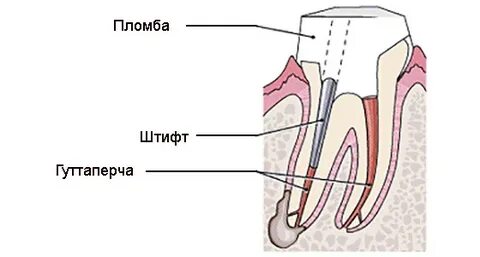 Пломбированный штифт