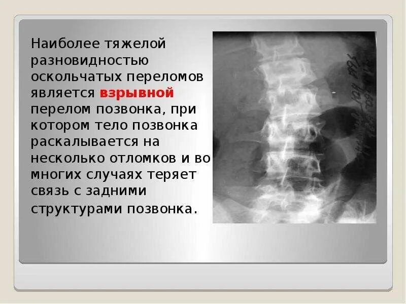 К чему может привести перелом. Причины закрытого перелома. Что делать припепеломе. К чему может привести перелом. Патологическая подвижность при переломе.