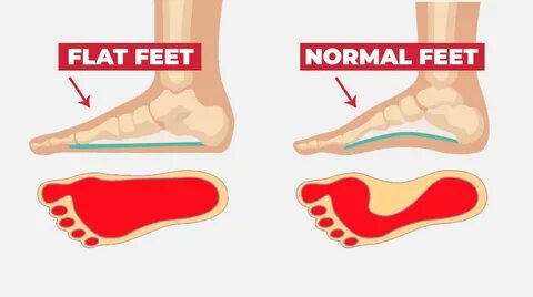 Foot check