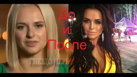 Дом 2 до и после пластики фото