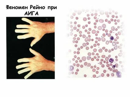 Феномен 5 лет