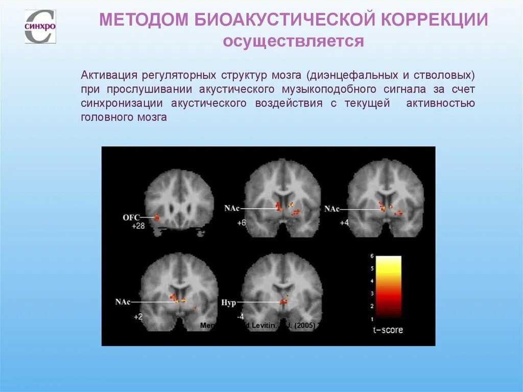 Биоакустическая коррекция это. Комплекс биоакустической коррекции синхро-с. Метод биоакустической коррекции. Биоакустическая коррекция мозга. Бак метод биоакустической коррекции.