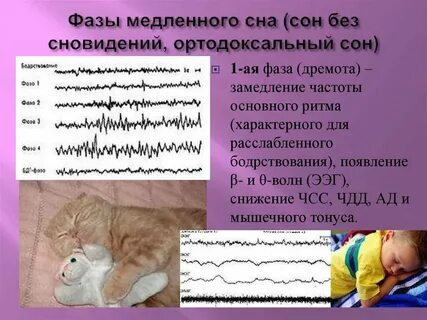 Фаза медленного сна
