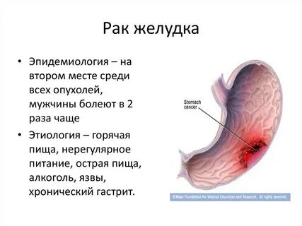 Может ли человек жить без желудка