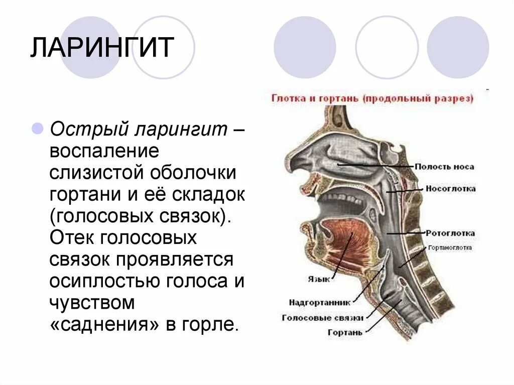 Лечение голосовых. Заболевания глотки и гортани.