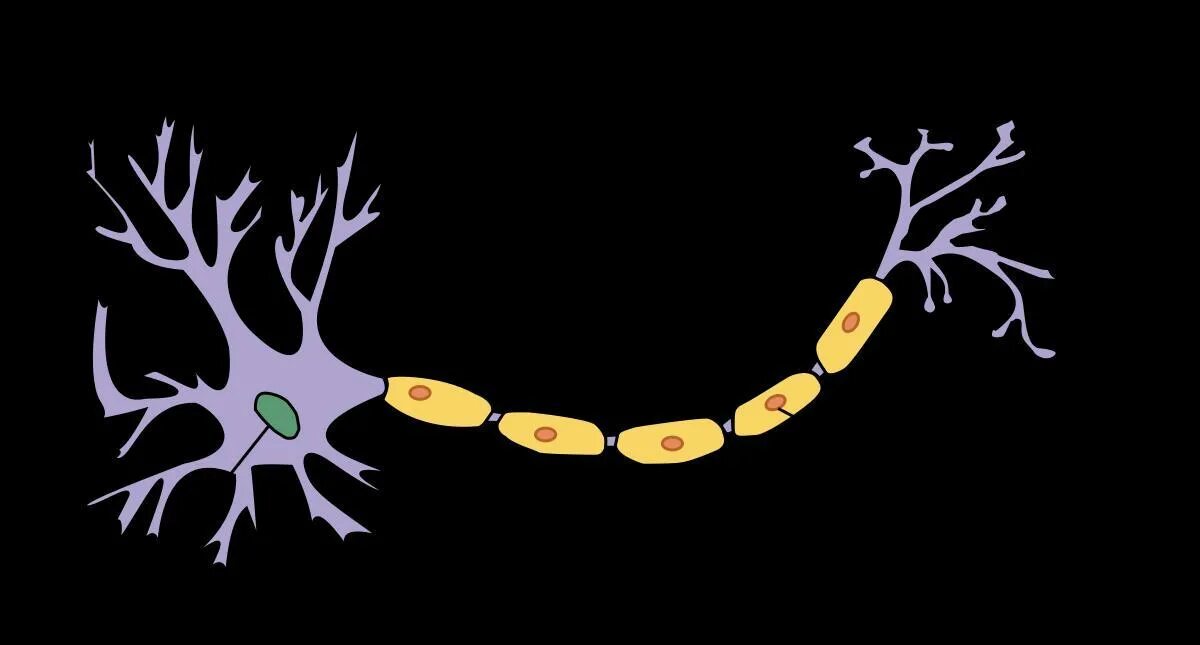 Демиелинизирующая нейропатия. Хронические Демиелинизирующие полинейропатии. Полинейропатия аксонально-демиелинизирующего типа. Демиелинизирующая моторная невропатия. Острая воспалительная демиелинизирующая полиневропатия.