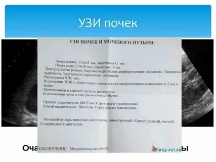 Исследование почек и надпочечников подготовка к исследованию