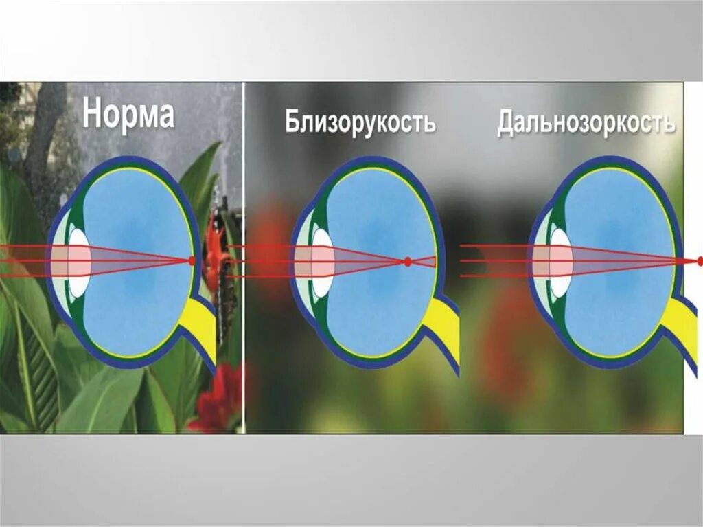 Как видят дальнозоркие люди