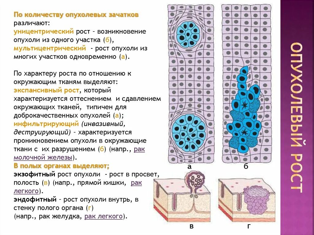 Уницентрический рост рост опухоли. Рост опухолевых клеток. Виды опухолевого роста схема. Характеристика опухолевого роста. Экспансивный рост это