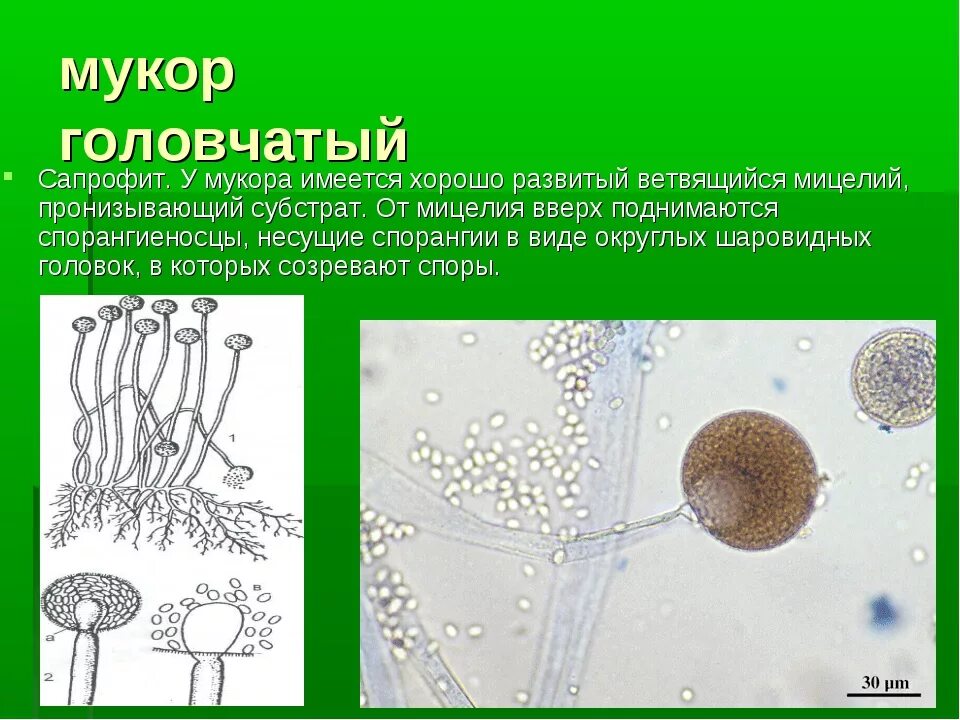 Многоклеточные грибы мукор. Строение плесневого гриба мукора. Строение клетки мукора. Мукор гриб паразит. Мукор это гриб паразит или нет.