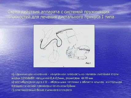Действия аппарата