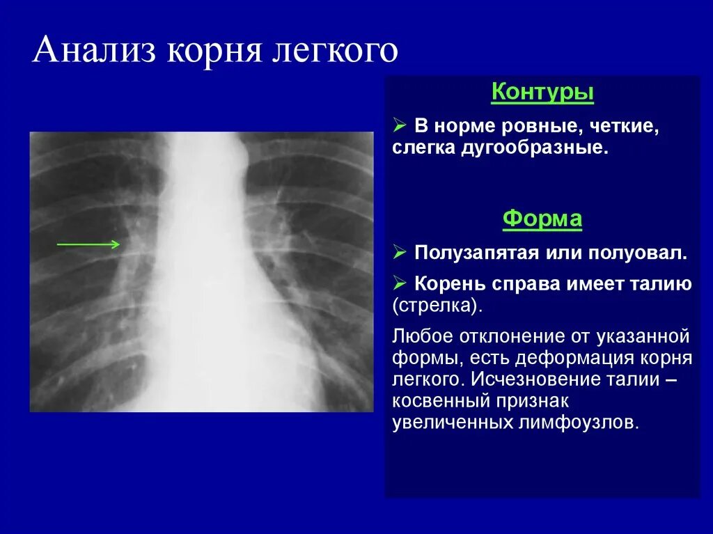 Хвостовой отдел легких