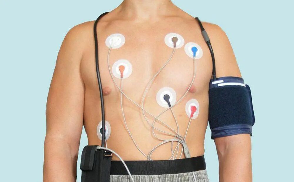 Смад холтер экг. Хм экг сердца что. Суточное мониторирование экг (холтеровское мониторирование). Холтеровский монитор экг валента. Холтеровский монитор экг крн-01.