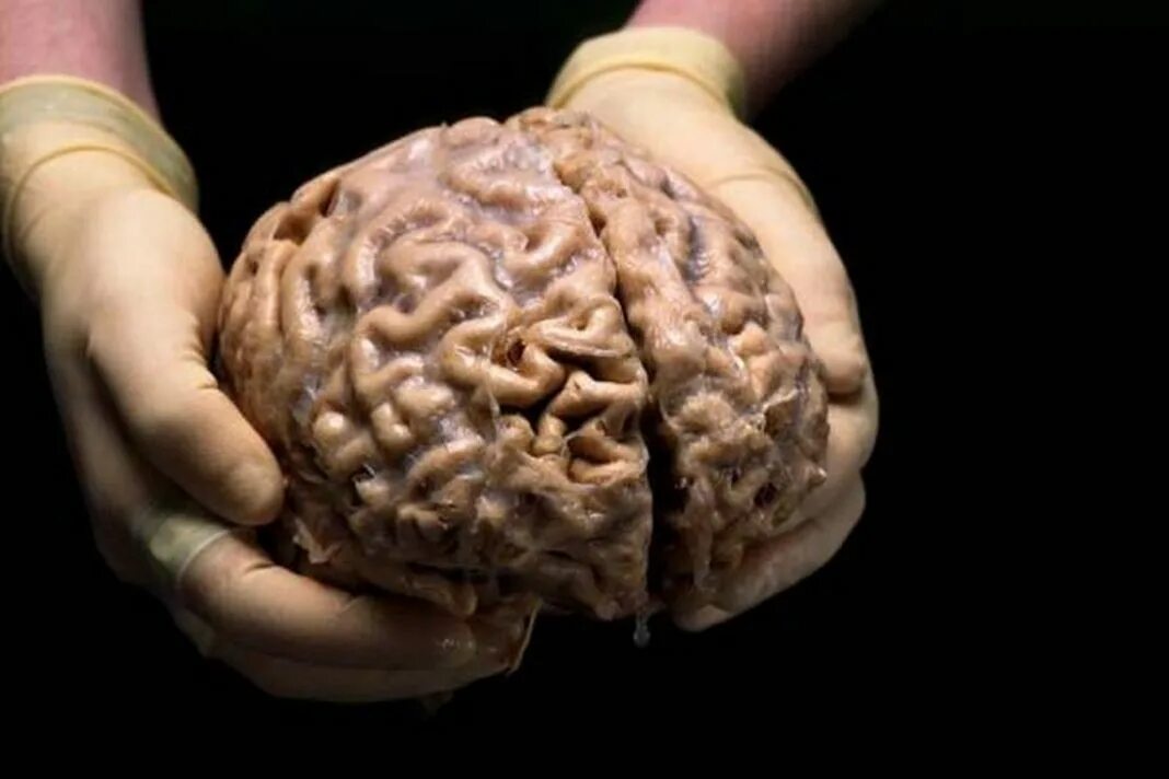 Головной мозг живой. Человеческий мозг живой.