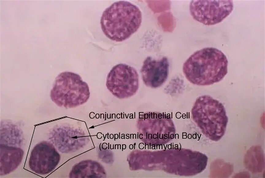 Микроскопия мазка хламидии. Хламидия трахоматис под микроскопом. Пятерка хламидия