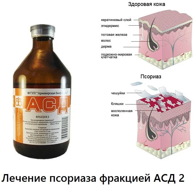 Асд можно применять. АСД фракция 2 ветеринарный препарат. Дозировки употребления АСД фракция 2. АСД-2 фракция при псориазе. АСД-фракция 2 от псориаза.