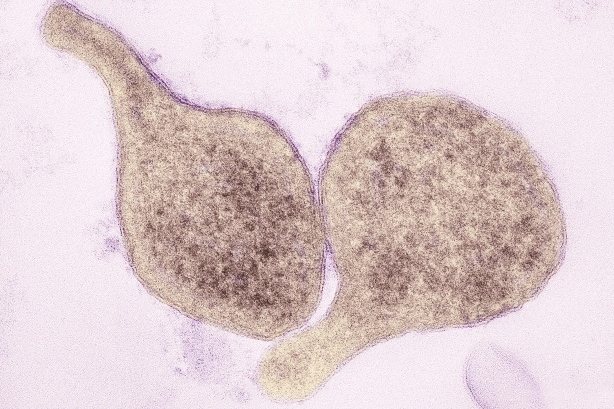Микоплазма половым путем. Микоплазма гениталиум. mycoplasma genitalium микроскопия. микоплазмы возбудители. микоплазма гениталиум под микроскопом.