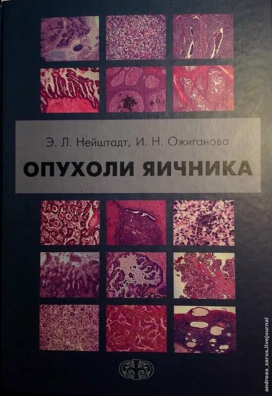 Опухоли яичника Нейштадт Ожиганова купить. Книги опухоль