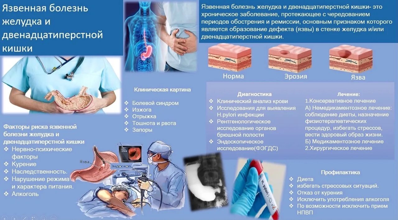 Язвенная болезнь санбюллетень. Санбюллетень язва желудка. Санбюллетень язвенная болезнь желудка и двенадцатиперстной кишки. Профилактика язвенной болезни желудка. Профилактическая язва