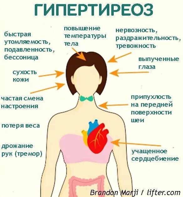 Гипертиреоз лечение у мужчин. Профилактика гипотиреоза у женщин. Гипотиреоз памятка. Профилактика гипотиреоза памятка. Гипотиреоз буклет.