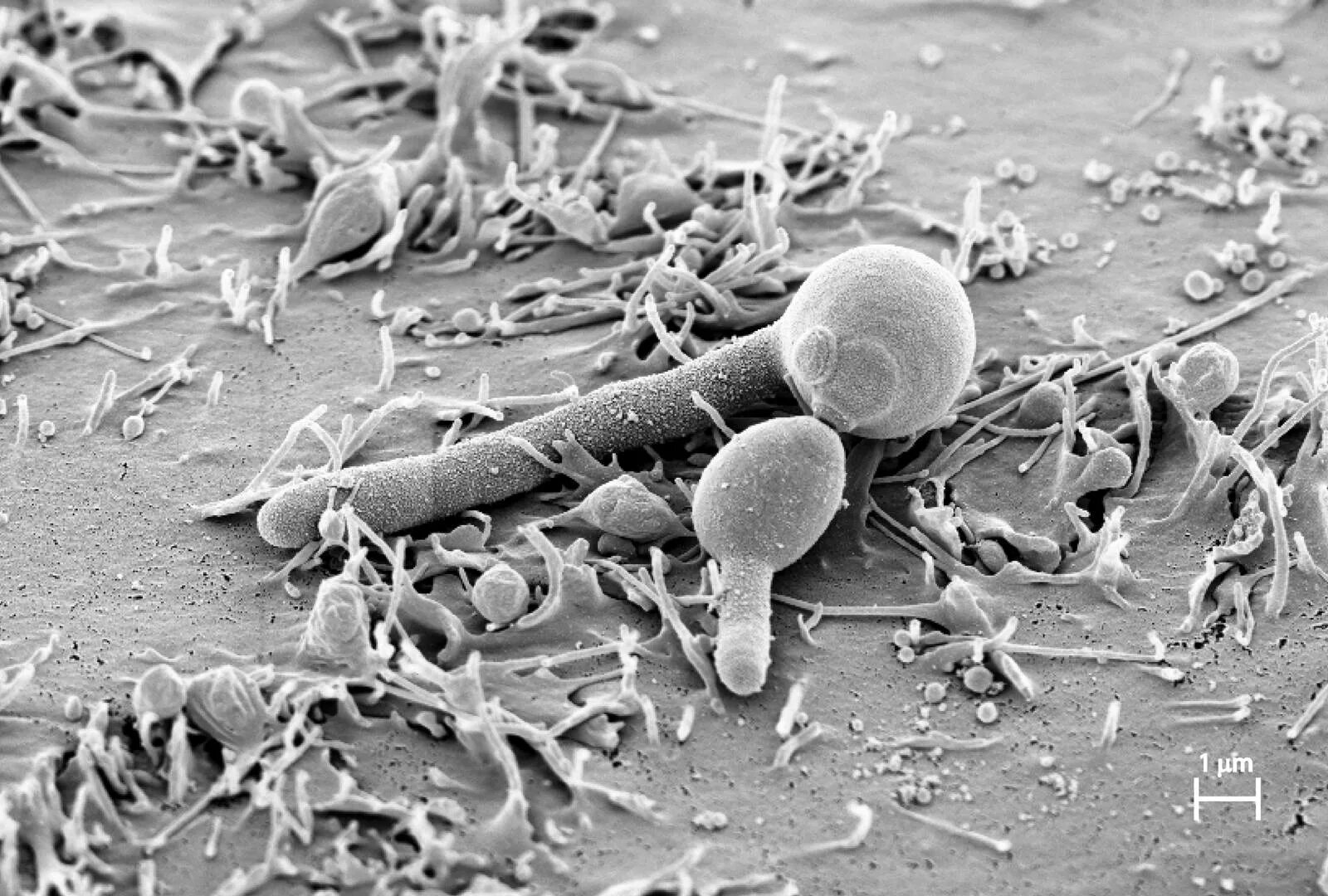 Молочница бактерии. Кандида альбиканс под микроскопом. Грибок кандида под микроскопом.