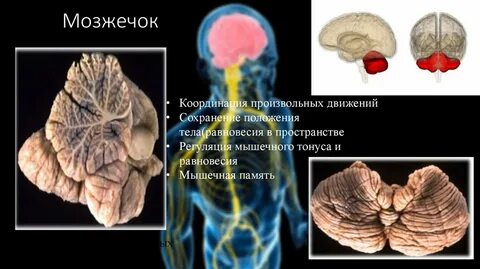 Изменения мозжечка