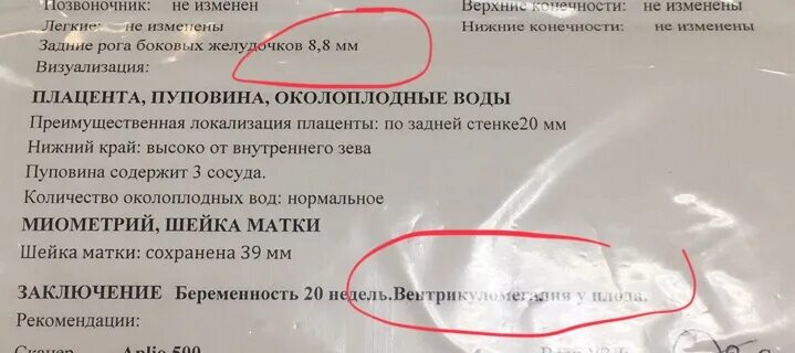 Задние рога боковых желудочков плода норма 20 недель норма. Задние рога боковых желудочков УЗИ. Задние рога боковых желудочков плода норма по неделям. Задние рога боковых желудочков плода.