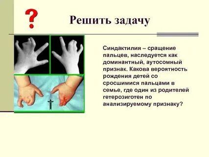 Полидактилия доминантный аутосомный