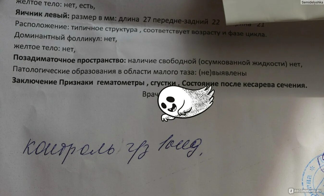 Гематометра симптомы. Заключение узи гематометра. послеродовая гематометра. гематометра после родов. гематометра на узи после родов.