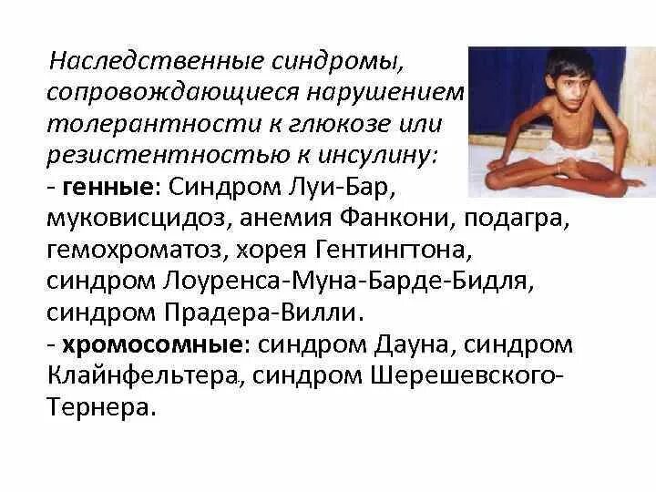 Синдром лоуренса муна барде бидля. Синдром луи-бар клиническая картина. синдромы лоуренса-барде-бидля-мун.