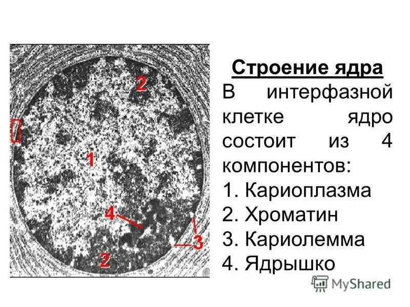 Строение ядрышка гистология. Строение ядра интерфазной клетки по электроннограмме. Строение ядра микрофотография. Структура интерфазного ядра гистология. В ядрах клеток многоклеточного