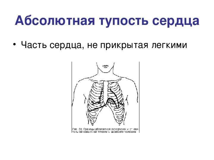 Относительная тупость