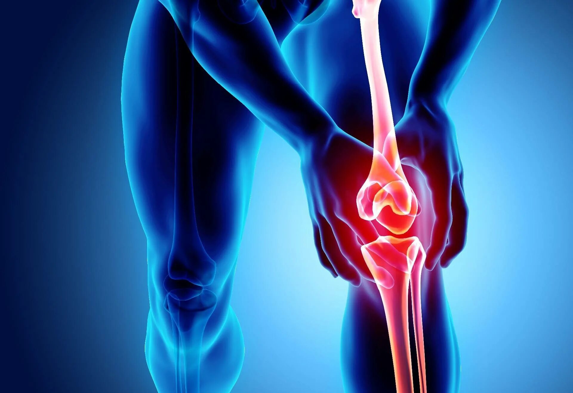 Артропатия лечение. Остеоартрит коленного сустава. Остеоартрит тазобедренного сустава. Боль в суставах.