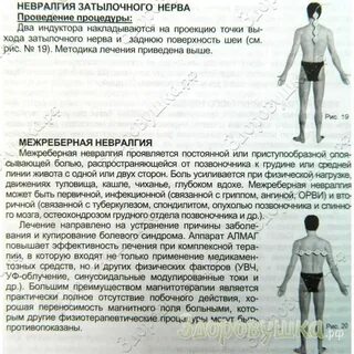 Невралгия инструкция по применению