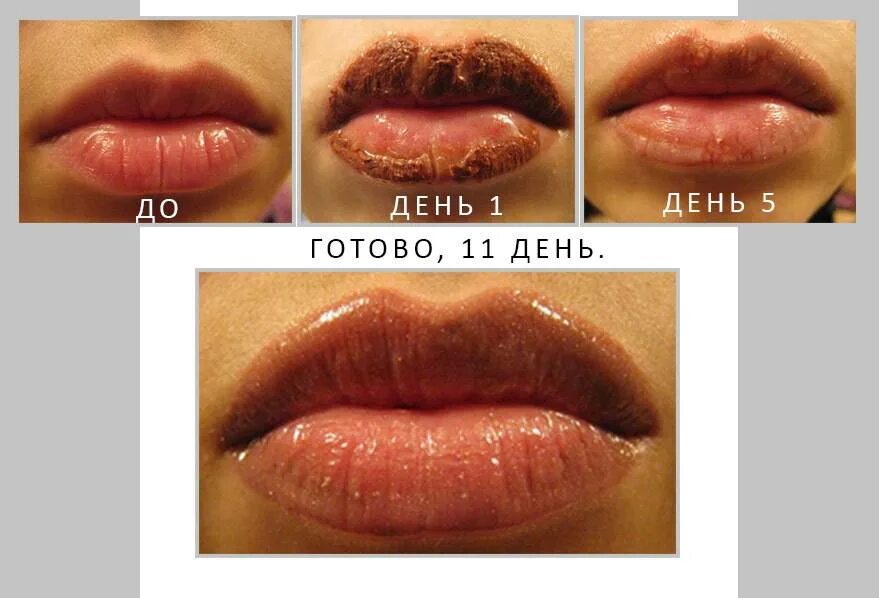 Сколько нельзя целоваться после увеличения. Заживление перманентного макияжа губ по дням. Техника татуажа губ «Lip Light». Перманентный макияж губ после заживления.