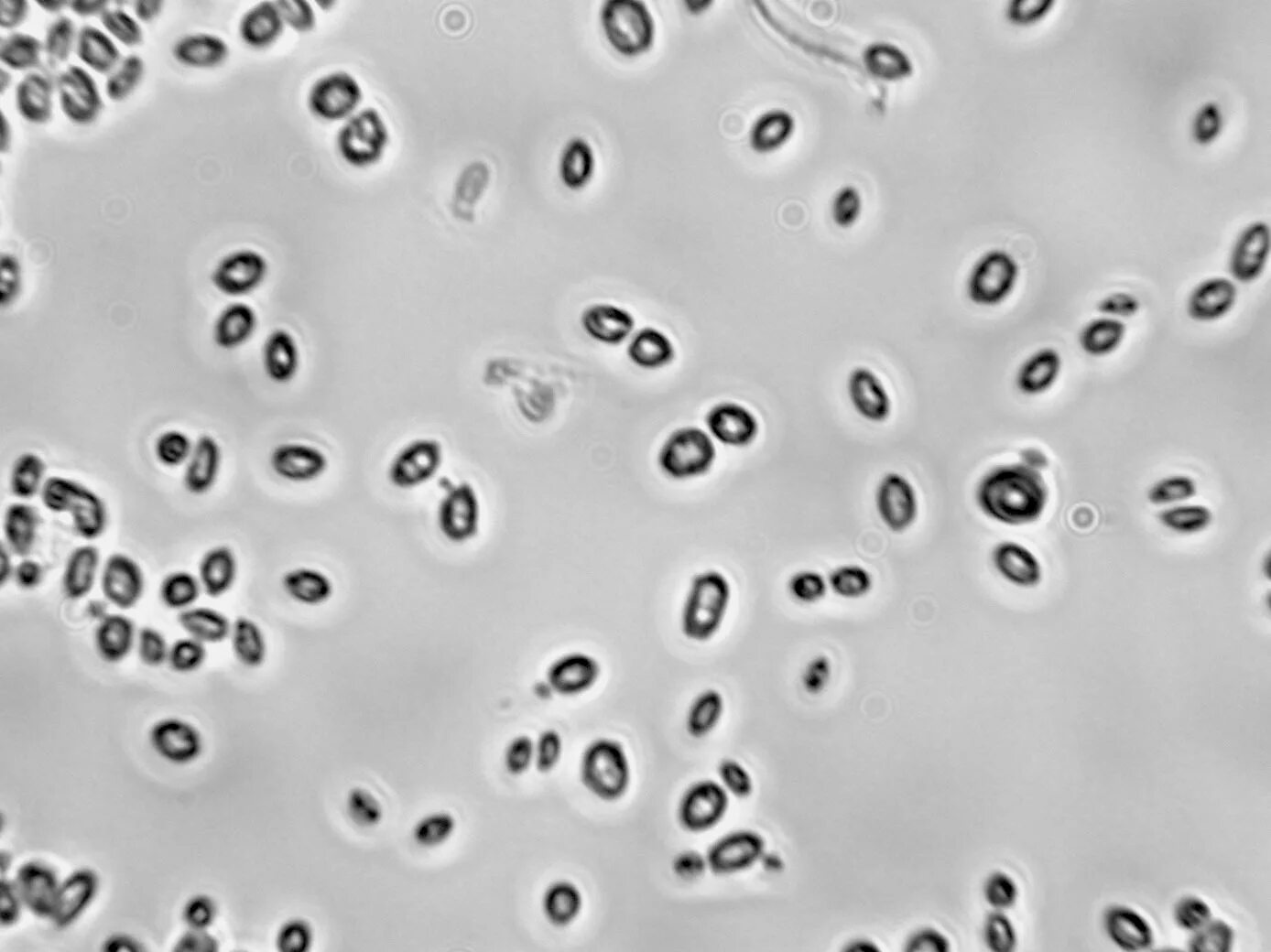 Дрожжевые клетки в моче повышены. Дрожжи микроскопия сахаромицеты. Saccharomyces cerevisiae микроскоп. Дрожжи Saccharomyces cerevisiae под микроскопом. Дрожжей Saccharomyces cerevisiae микроскопия.