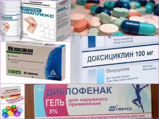 Лечение артрита суставов препараты для лечения. Лекарство от артрита. мазь от артрита голеностопного сустава. таблетки от артрита. лекарства от артрита голеностопного сустава.