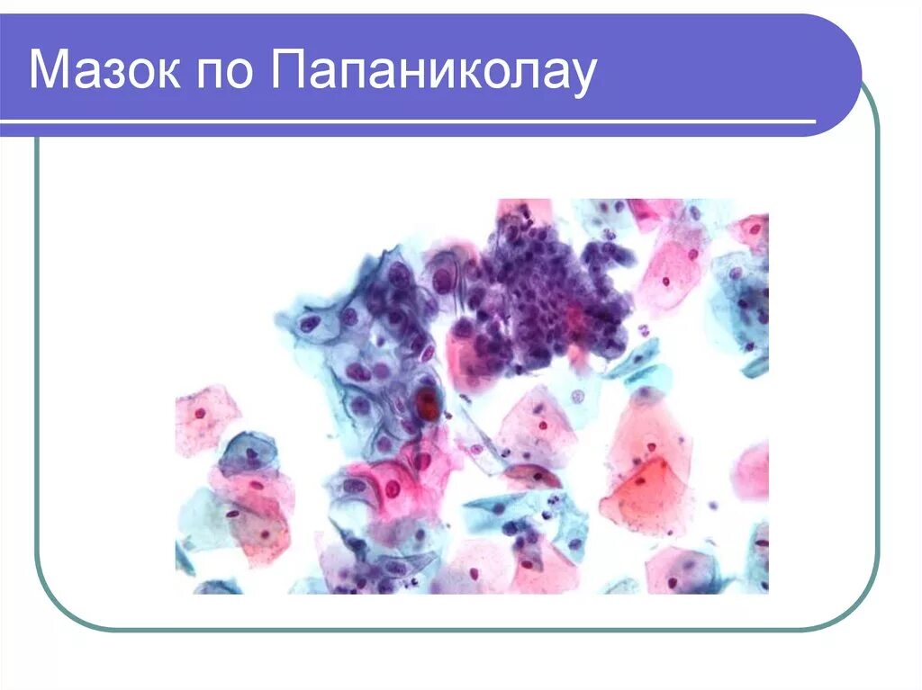 Окраска по Папаниколау цитология. Окраска мазков по Папаниколау. Покраска цитологических мазков по Папаниколау. Цитологический мазок (пап-тест, тест Папаниколау). Пап тест шейки