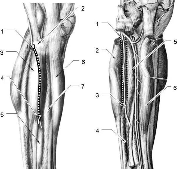 Нижний мышечно-малоберцовый канал анатомия. Топографическая анатомия малоберцового нерва. Верхний и Нижний малоберцовые каналы. Верхний мышечно малоберцовый канал топография.