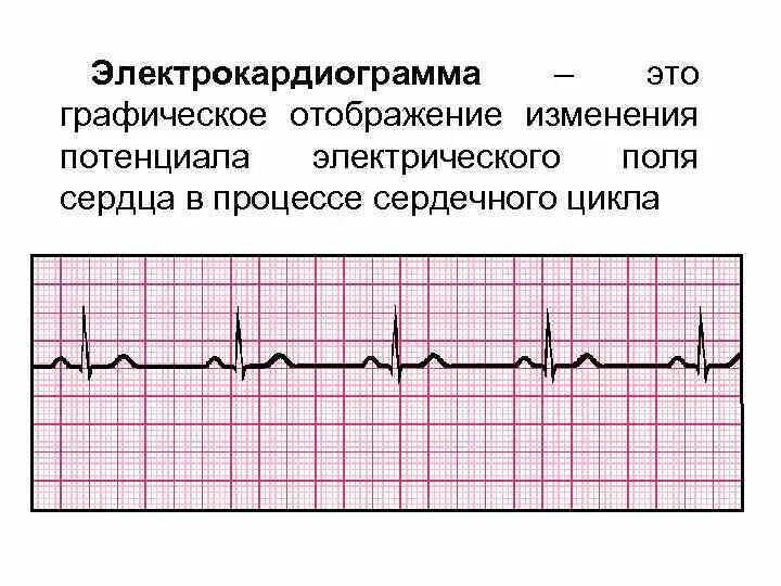 Цикл экг. Сердечный цикл на ЭКГ. ЭКГ нормальная физиология. Электрокардиограмма этаграфиское отображение. Фазы сердечного цикла на ЭКГ.