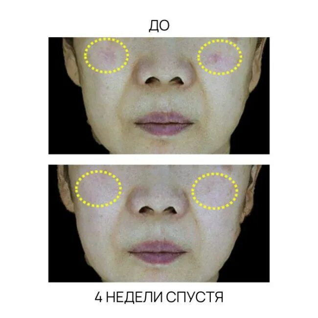 Cosrx the vitamin c 13 serum. Cosrx the vitamin c 13 serum