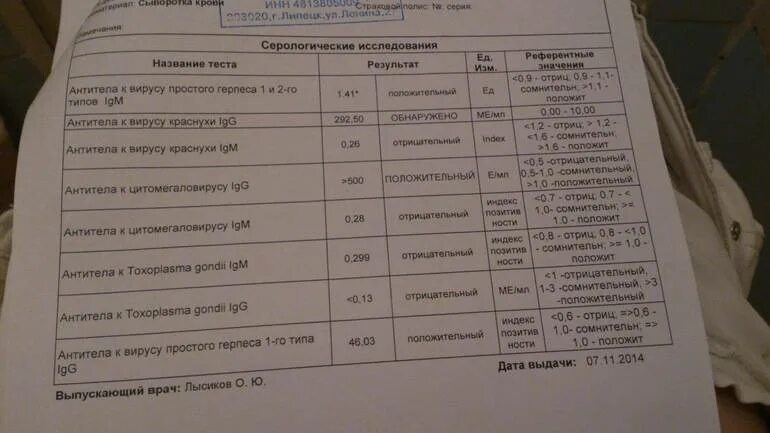 Срок анализа на корь. Антитела к краснухе IGG норма. Титр антител к вирусу 1 к1. Антитела к вирусу краснухи LGG норма. Антитела цитомегаловирус IGG 1.2.