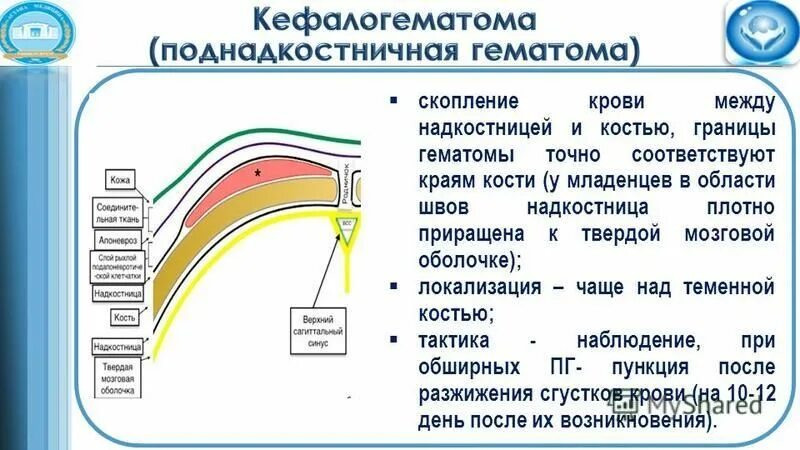 надкостница. периостит надкостницы. негнойному остеомиелит. травма надкостницы. надкостница большеберцовой кости болит.