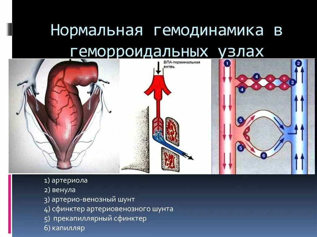 Геморроидальные венозные узлы. Механизм развития геморроя. Венозный узел геморрой. Гемодинамика геморроидальных узлов. Малоинвазивное лечение геморроя