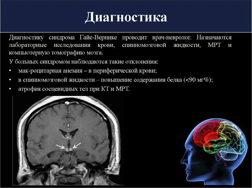 Энцефалопатия Вернике мрт. Мрт при энцефалопатии Вернике. Гайе-Вернике алкогольная энцефалопатия. Энцефалопатия Вернике кт. Хтэ болезнь