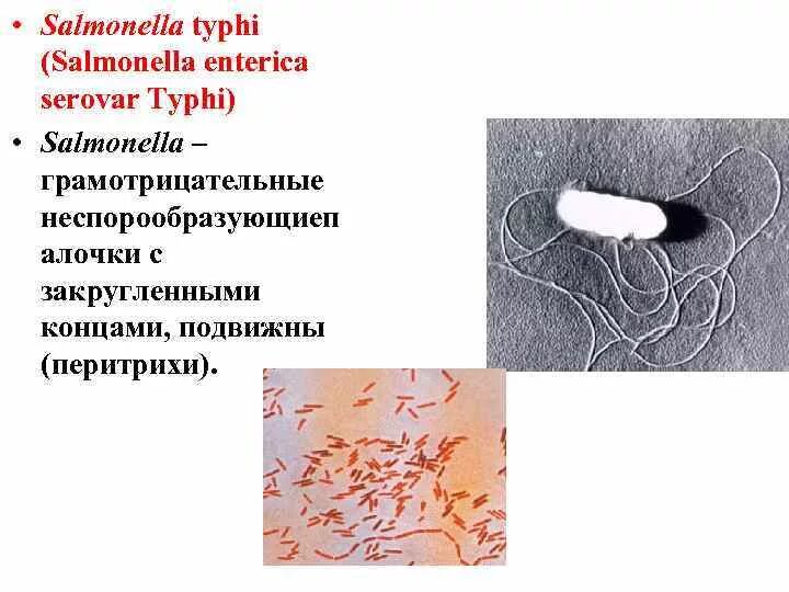 Сальмонелла энтерика Тифи. Брюшной тиф сальмонелла Тифи. Возбудитель брюшного тифа микробиология. Salmonella Typhimurium микробиология. Сальмонеллез и брюшной тиф