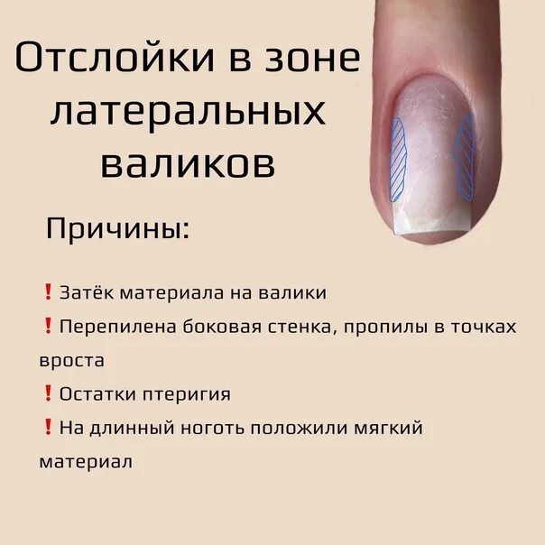 Почему происходит отслойка геля
