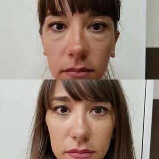 Как замаскировать малярные мешки