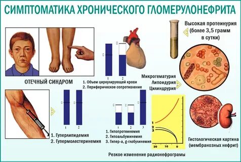 Гломерулонефрит симптомы